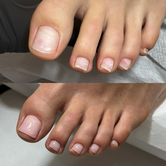 Pedicure 1+2 (ACCONTO)