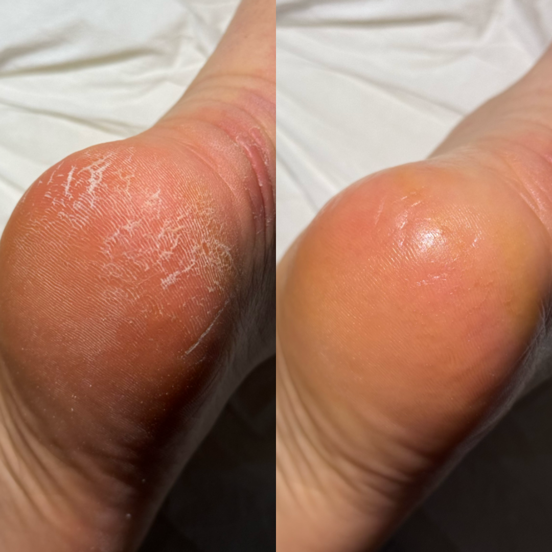 Pedicure 1+2 (ACCONTO)