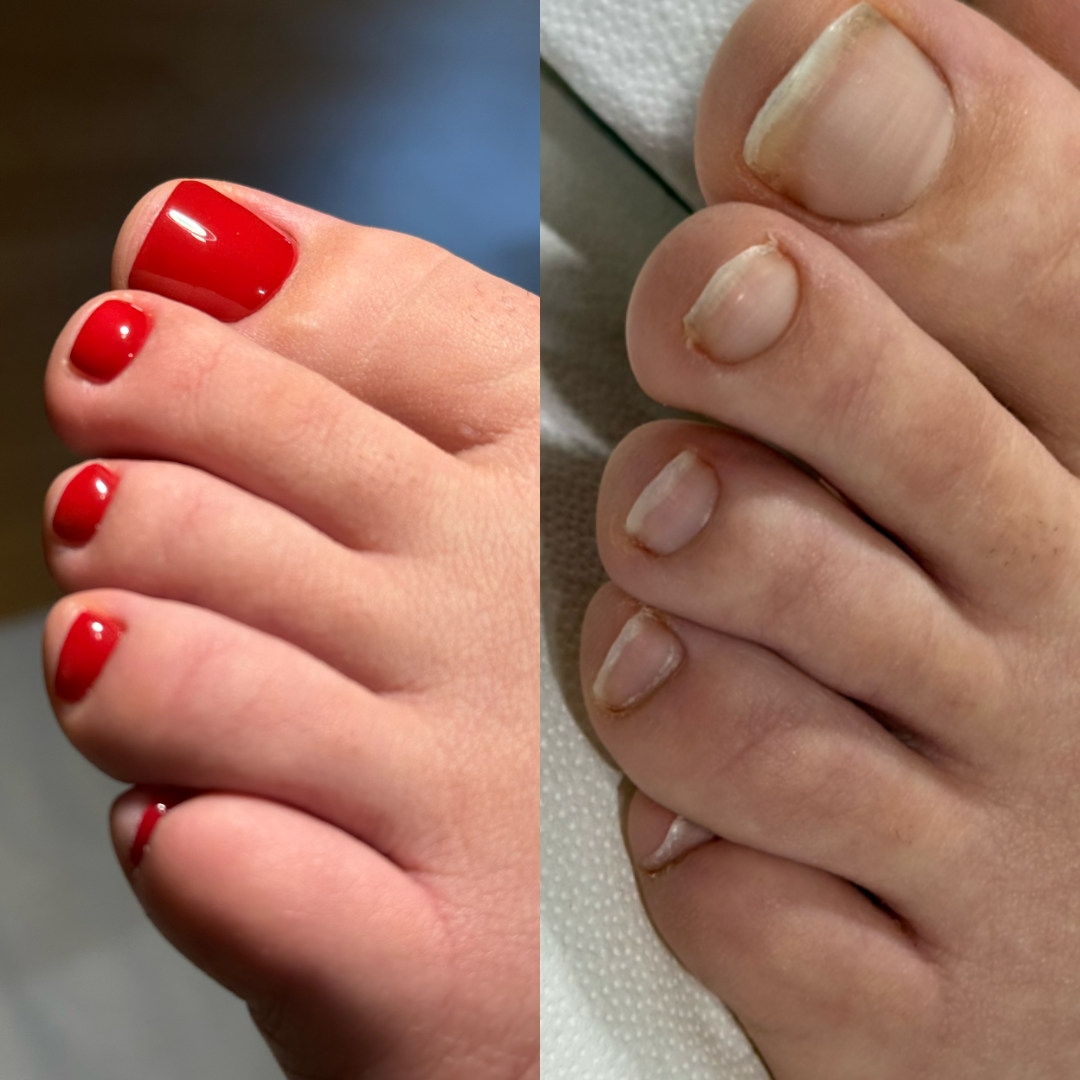 Pedicure 1+2 (ACCONTO)