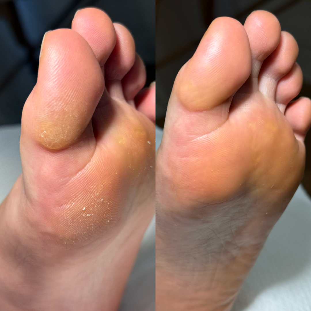 Pedicure 1+2 (ACCONTO)