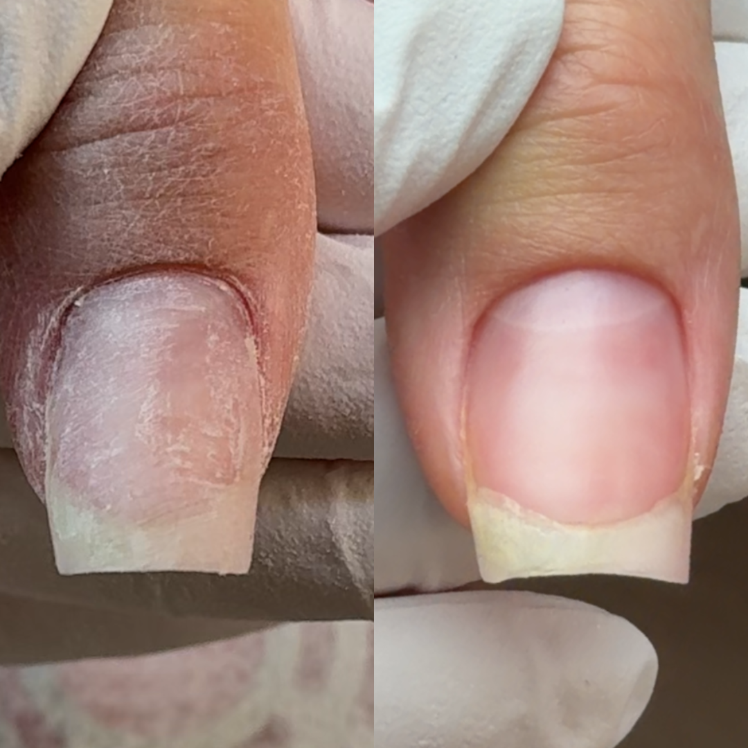 Refill Pro